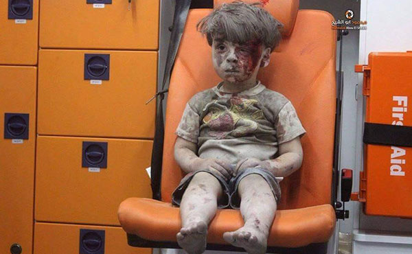 Omran Daqneesh, the five years old syrian boy wounded in Aleppo by russian bombardements.