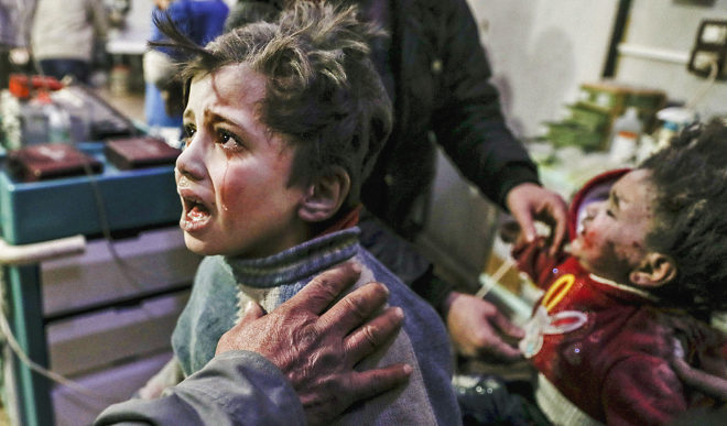 Dos niños son atendidos tras el ataque de Asad Siria