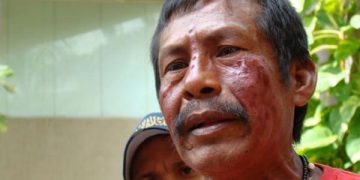 El 3 de marzo fue asesinado el cacique yukpa Sabino Romero por parte de sicarios