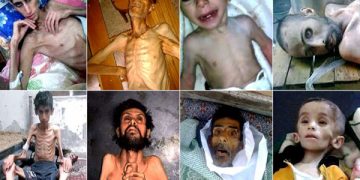 Madaya es una pequeña ciudad montañosa que padece las consecuencias de la guerra y del genocidio que practica el dictador Bashar Al Assad, avalado por Rusia y las potencias imperialistas.