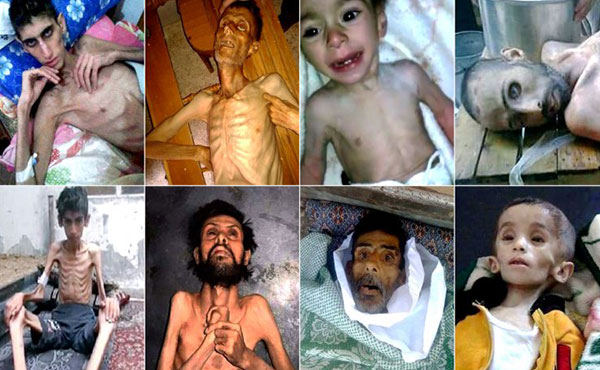 Madaya es una pequeña ciudad montañosa que padece las consecuencias de la guerra y del genocidio que practica el dictador Bashar Al Assad, avalado por Rusia y las potencias imperialistas.