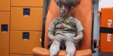 Omran Daqneesh de 5 años sobrevivió ayer a un bombardeo de la avición rusa sobre su casa en Aleppo, Siria.