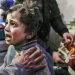 Dos niños son atendidos tras el ataque de Asad Siria