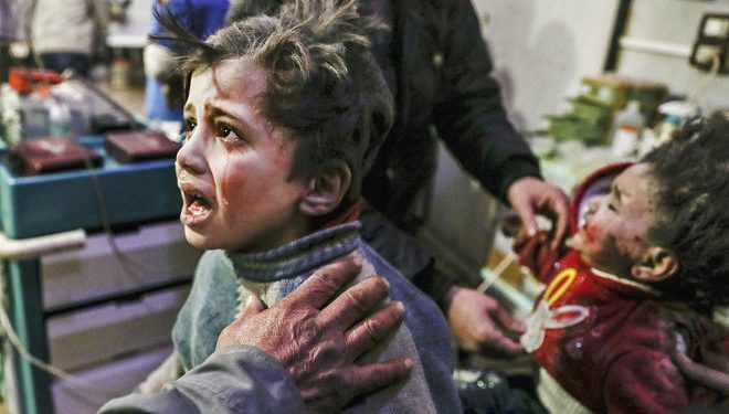 Dos niños son atendidos tras el ataque de Asad Siria